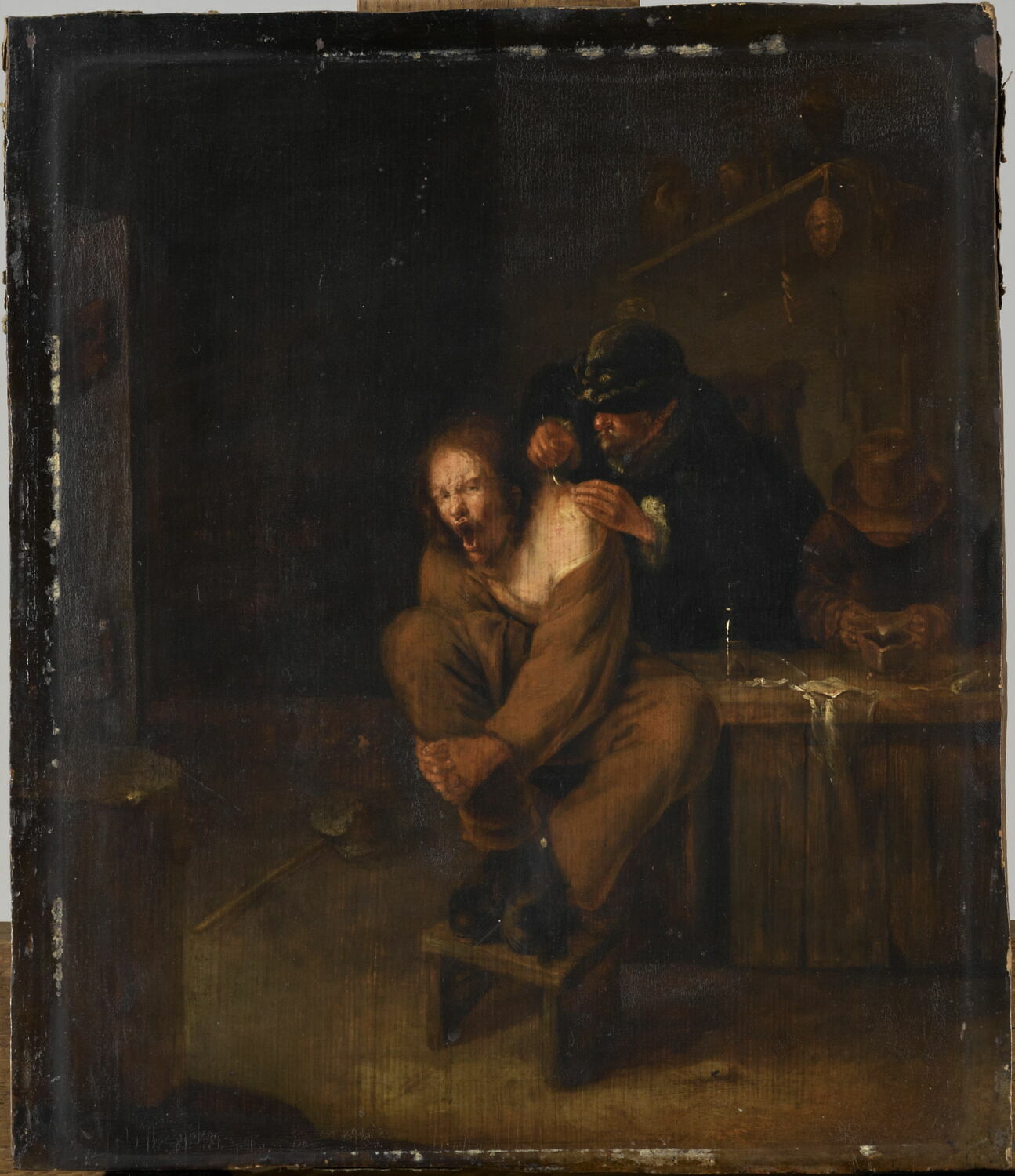 L'Opération.Chirurgien de village traitant une plaie à l’épaule d’un patient, Lundens, Gerrit, XVIIe siècle (1617)