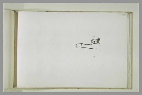 Tête et bras d'un homme, image 1/1