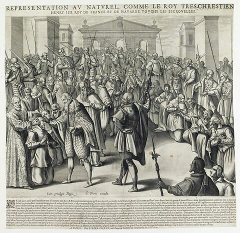 Henri IV touche les écrouelles, image 1/1