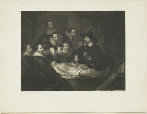 La leçon d'anatomie, image 1/1