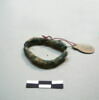 anneau  ; os, image 3/17